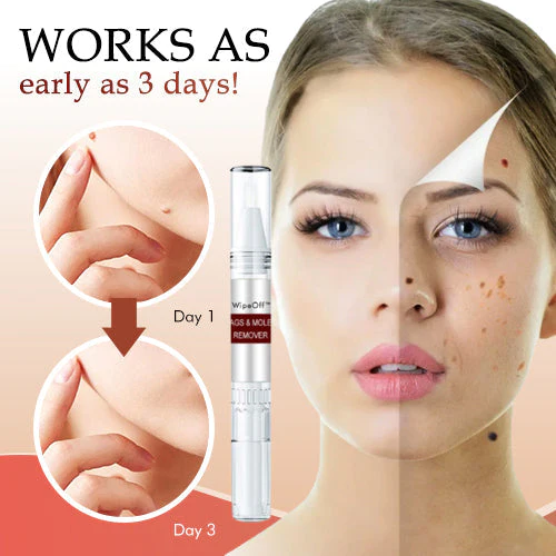 Tags & Moles Remover - Image 5