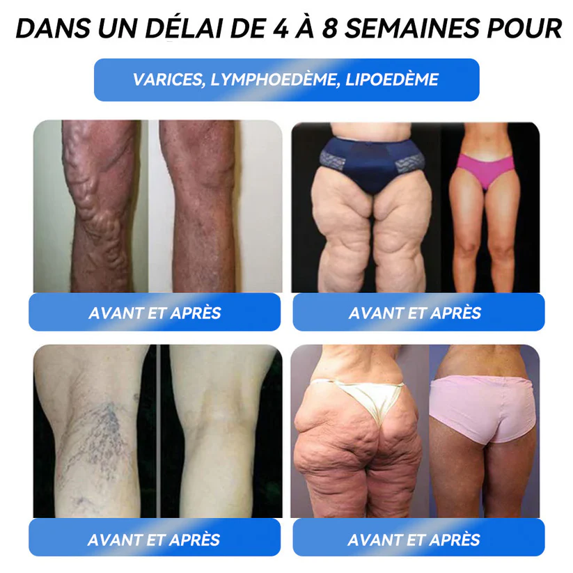 Solution orale pour la perte de poids - Image 13