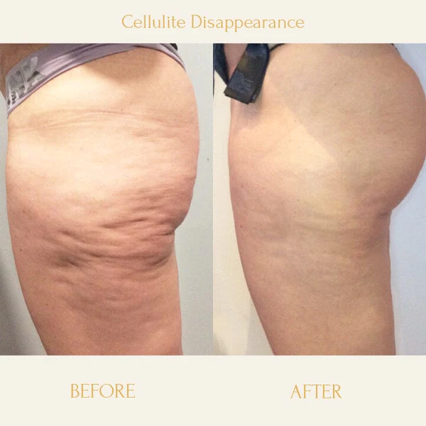 Anti-Cellulite Firming Soap - Image 4