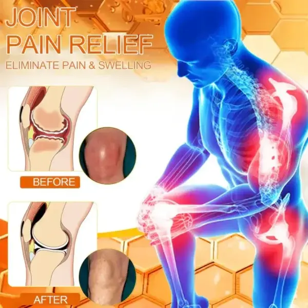 Magnesium Oil & Bee Venom Joint Healing Spray - Image 8
