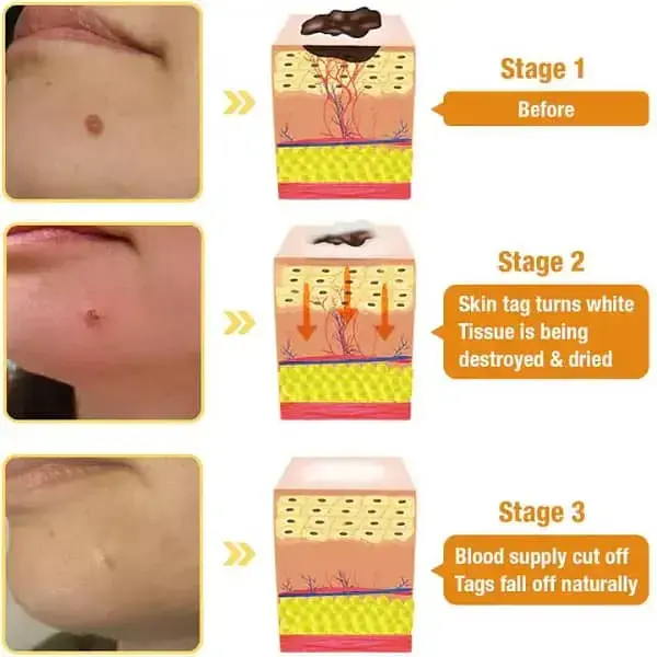 TagRecede Bee Venom Treatment Spray - Image 8