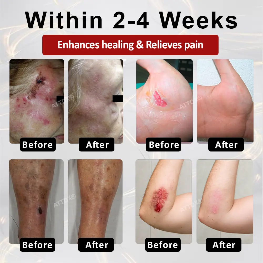 GlucoseGuard Skin Rescue Cream - Image 7
