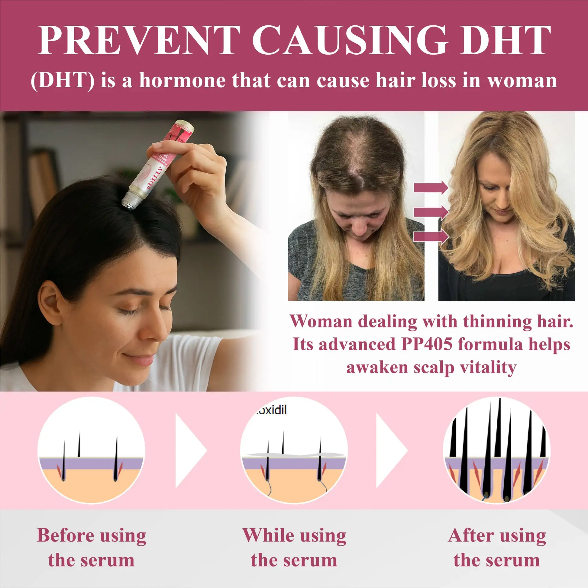 Hair Reawaken PP405 Roll-On Serum for Women 👩 - Image 8