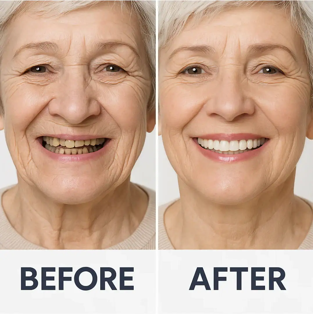 🦷Advanced Customized Full Denture Set🦷 (⏰Limited time discount last 30 minutes⏰) - Image 4