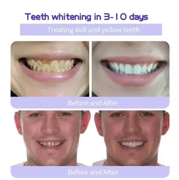 TeethRestoration Mineral Powder - Image 9