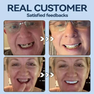 👧🏻🔆- 𝐏𝐫𝐞𝐦𝐢𝐮𝐦 𝐃𝐞𝐧𝐭𝐮𝐫𝐞- (✨Suitable for all mouth shapes, custom-made dentures for a perfect fit✨) - Image 8
