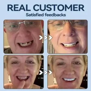 👧🏻🔆- 𝐏𝐫𝐞𝐦𝐢𝐮𝐦 𝐃𝐞𝐧𝐭𝐮𝐫𝐞- (✨Suitable for all mouth shapes, custom-made dentures for a perfect fit✨) - Image 8