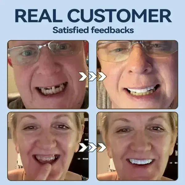 👧🏻🔆- 𝐏𝐫𝐞𝐦𝐢𝐮𝐦 𝐃𝐞𝐧𝐭𝐮𝐫𝐞- (✨Suitable for all mouth shapes, custom-made dentures for a perfect fit✨) - Image 8