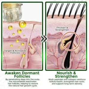 Herbal Infusion Hair Stimulation Set - Image 6