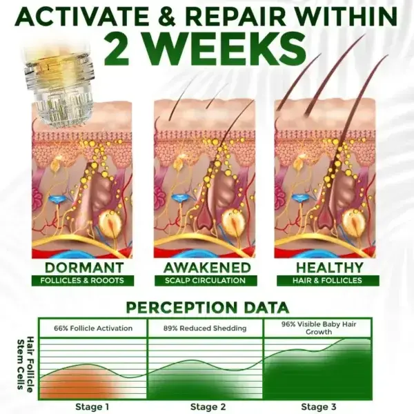 Herbal Infusion Hair Stimulation Set - Image 7