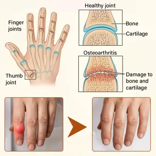 VenomEase Joint Cream - Image 9