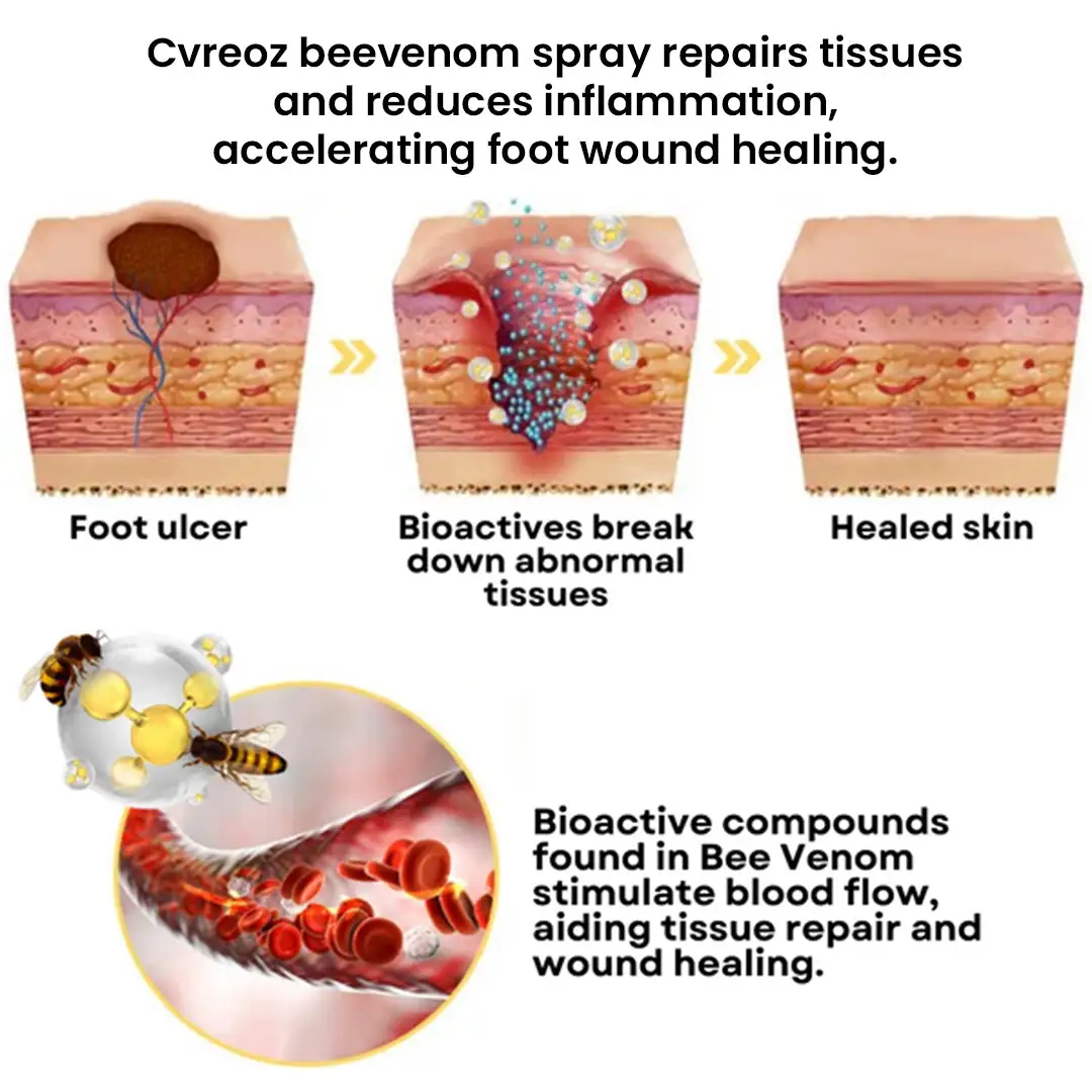 Bee Venom Diabetic Foot Healing Spray - Image 12