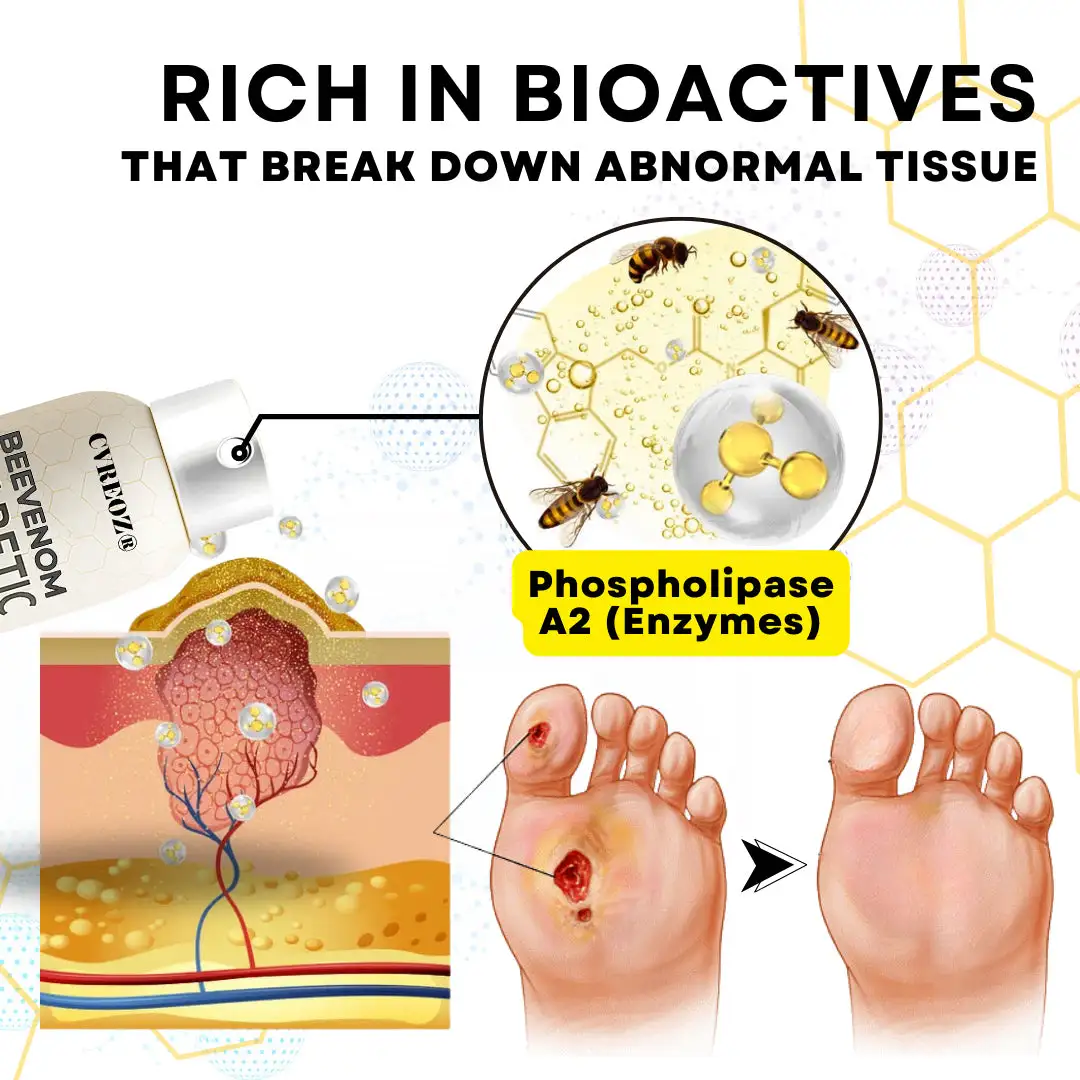 Bee Venom Diabetic Foot Healing Spray - Image 9
