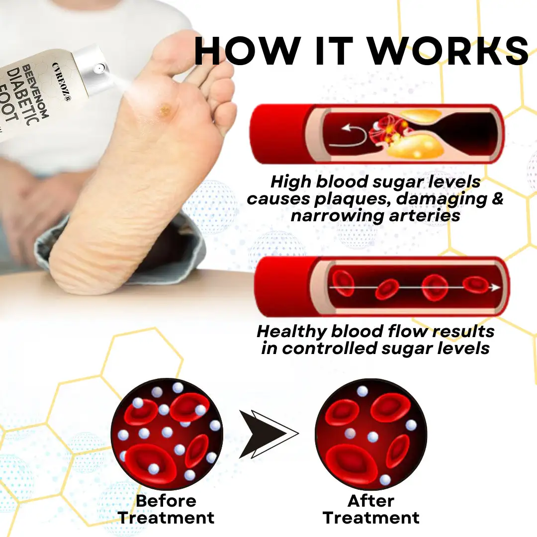 Bee Venom Diabetic Foot Healing Spray - Image 10