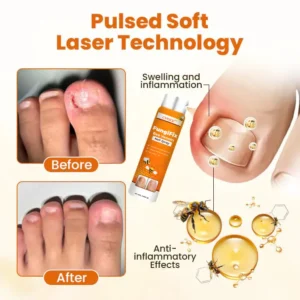 Bee Venom Nail Spray - Image 5