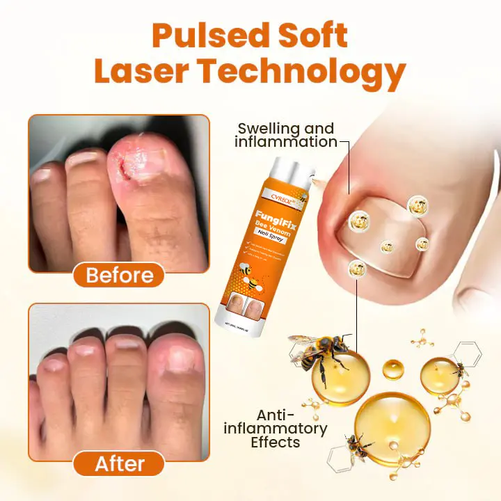 Bee Venom Nail Spray - Image 5