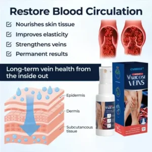 Varicose Veins Spray - Image 3