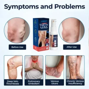 Varicose Veins Spray - Image 5