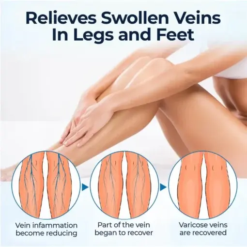 Varicose Veins Spray - Image 8