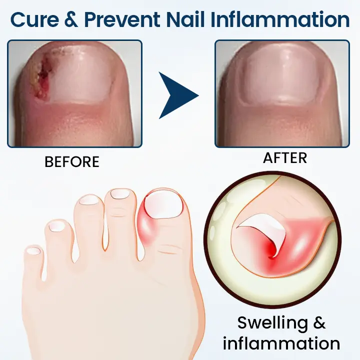 Fungal Repair Herbal Spray - Image 8