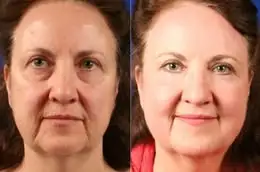 Eye Serum Capsules - Image 12