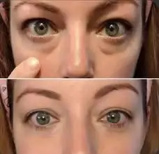 Eye Serum Capsules - Image 13