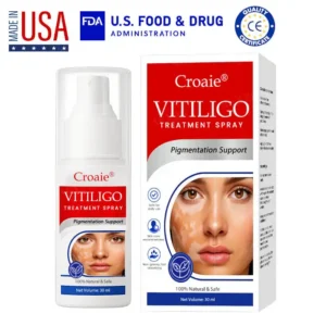 Vitiligo Treatment Spray