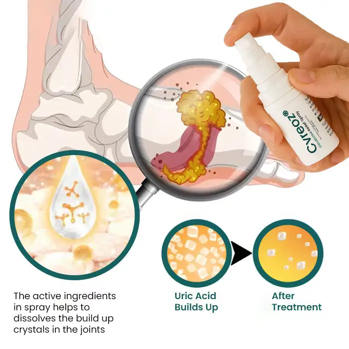 GoutEase Relief Spray - Image 5