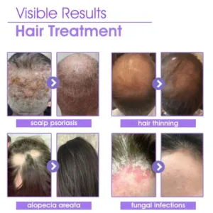 ✨👩🔬 Hair Root Repair Growth Drops - Image 3