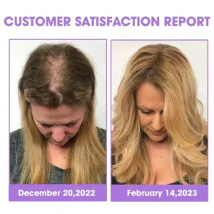 ✨👩🔬 Hair Root Repair Growth Drops - Image 5