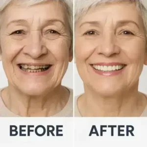 🦷 Custom-Fit Functional Dentures 😁 Smile with Confidence - Image 4