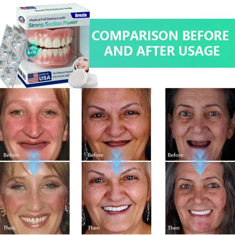 Full Denture with Strong Suction - Image 3