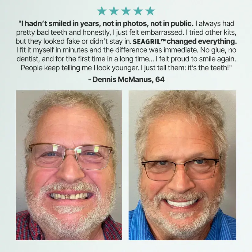 Fit Full Functional Dentures - Image 6