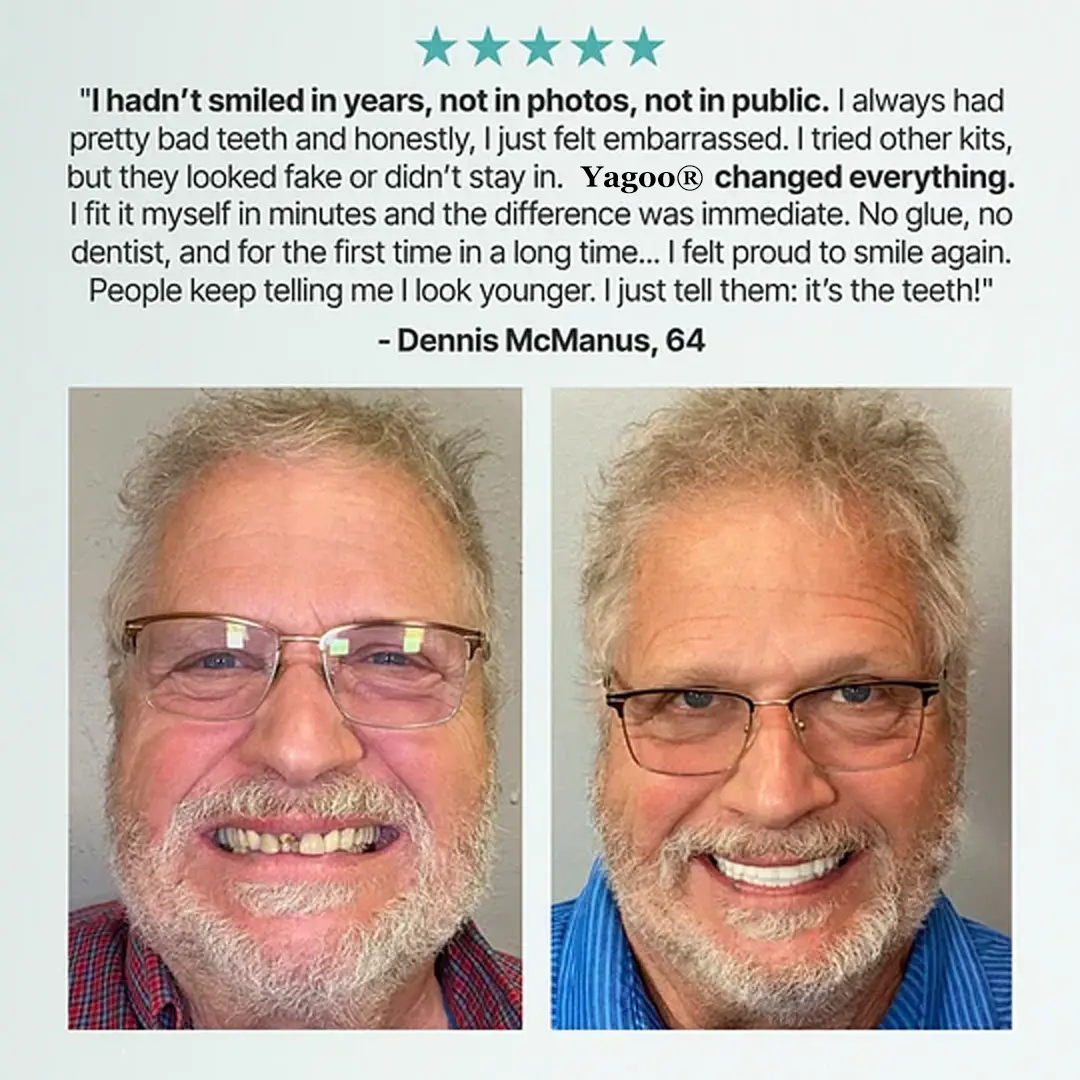 Custom-Fit Full Functional Dentures - Image 11