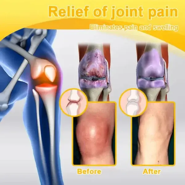 Pain-Relief Bone Healing Cream - Image 10