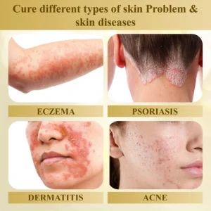 Venom Skin Repairing Cream - Image 12