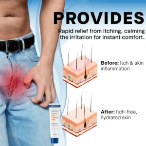 Scrotum Itchy Treatment Cream - Image 7