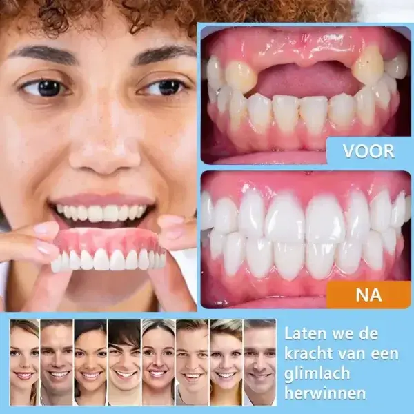 Geavanceerde op maat gemaakte volledige protheseset🌸 - Image 11