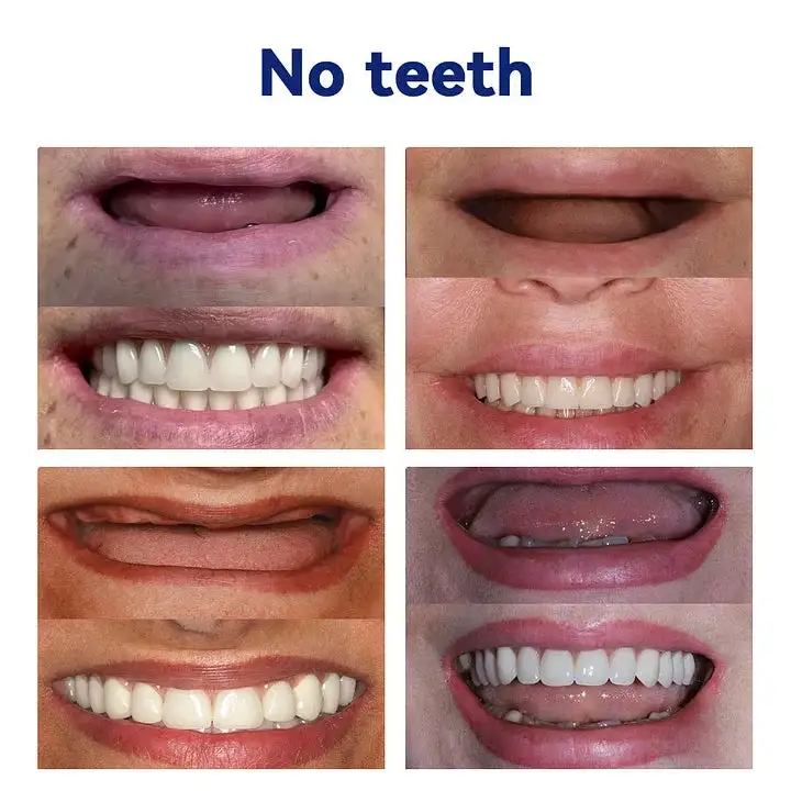 🧡Premium Advanced Customized Full Denture Set 🧡 - Image 3
