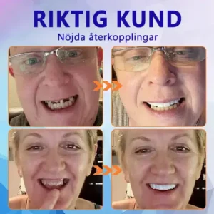 🧡Premium Avancerat Anpassat Helprotes-set 🧡 (⏰Tidsbegränsad rabatt i 30 minuter) - Image 10