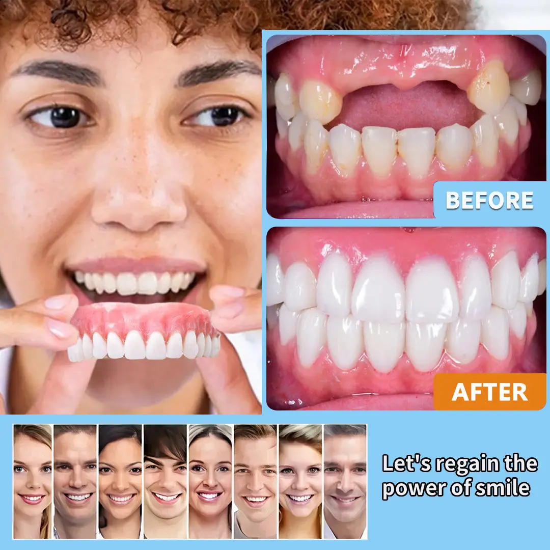 Premium Customized Full Denture Set🦷 - Image 13