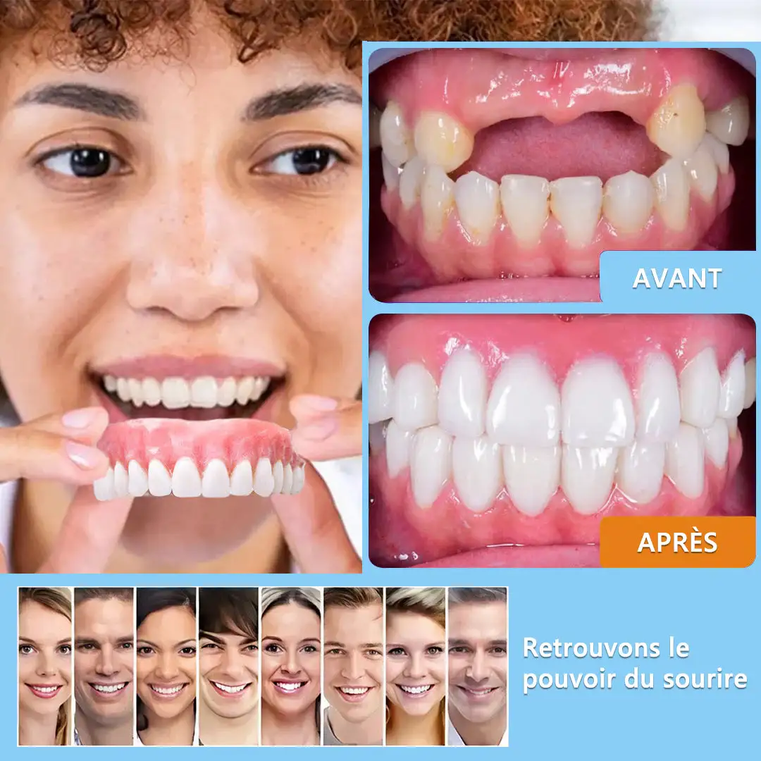 Prothèse Dentaire Complète Sur Mesure Haut de Gamme - Image 5