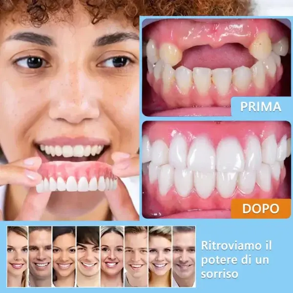 Set di protesi dentarie complete personalizzate avanzate🦷 - Image 7