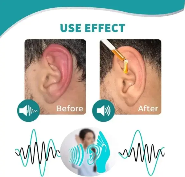 Ear Care Drops - Image 6