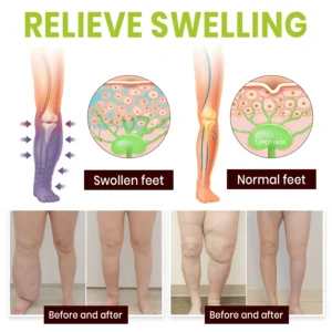 Professional Leg Circulation Cream - Image 4