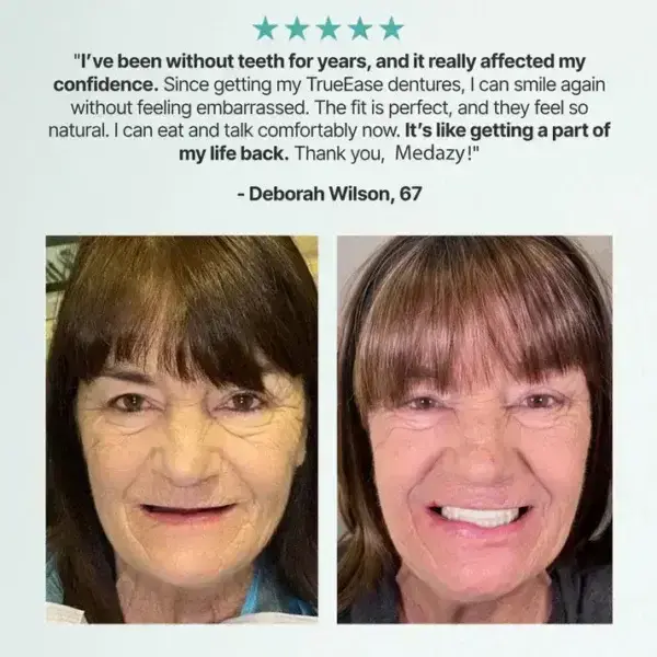 Custom-Fit Full Functional Dentures - Image 10