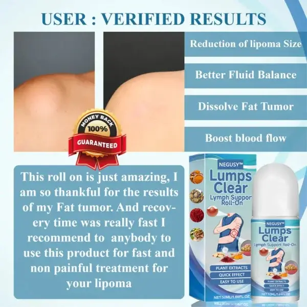 Support Roll-On - Image 3