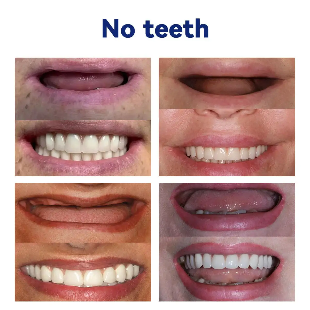 🦷Advanced Customized Full Denture Set🦷 - Image 13