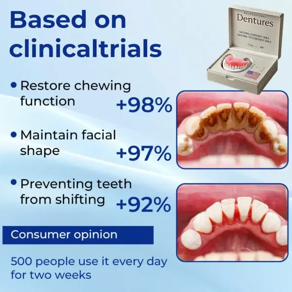 Advanced Customized Full Denture Set - Image 8