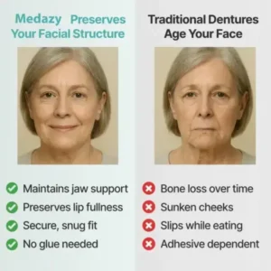 Custom-Fit Full Functional Dentures - Image 7